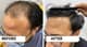 Slider image (10) Zeeva Skin & Hair Clinic